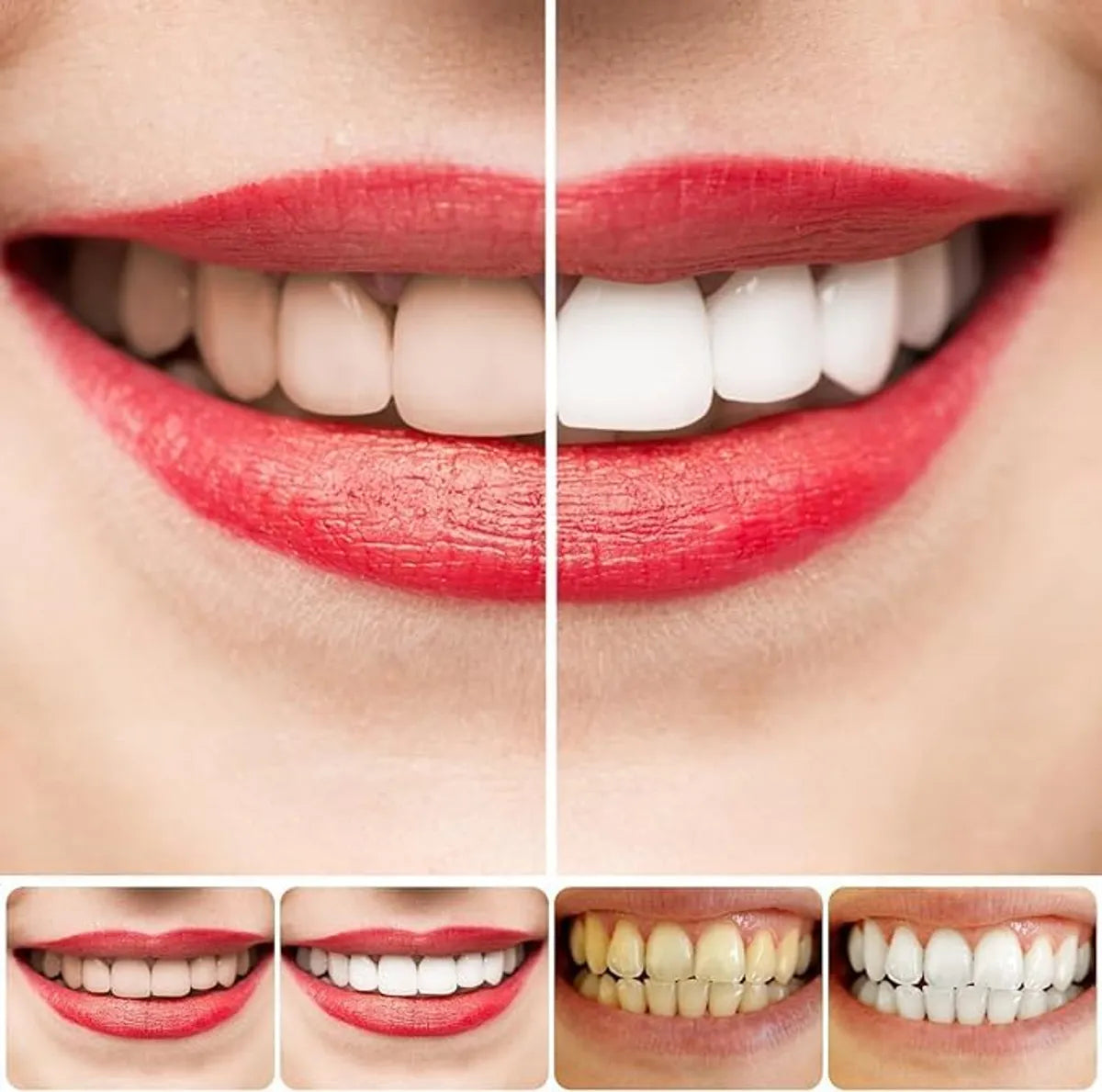SP4 Ultra Whitening Toothpaste (Buy 1 Get 1 Free)