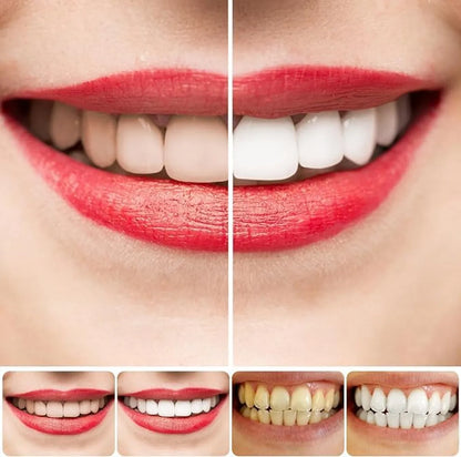 SP4 Ultra Whitening Toothpaste (Buy 1 Get 1 Free)