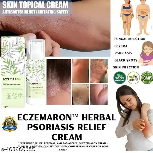 Anti Fungal Eczema Cream | (Buy 1 Get 1 Free)