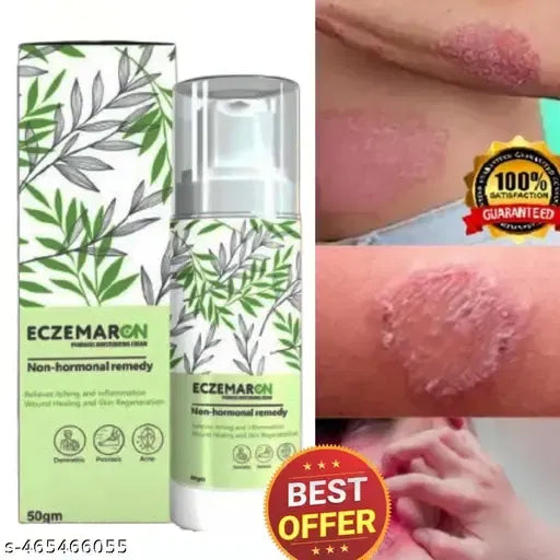Anti Fungal Eczema Cream | (Buy 1 Get 1 Free)