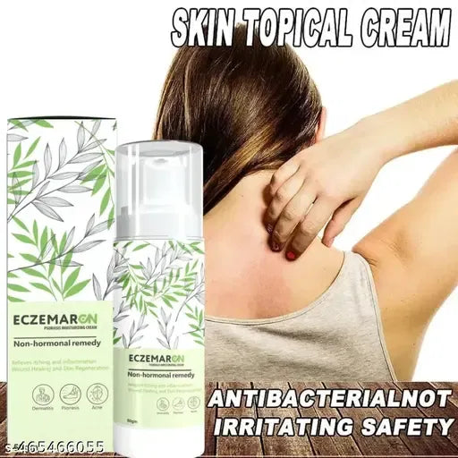 Anti Fungal Eczema Cream | (Buy 1 Get 1 Free)